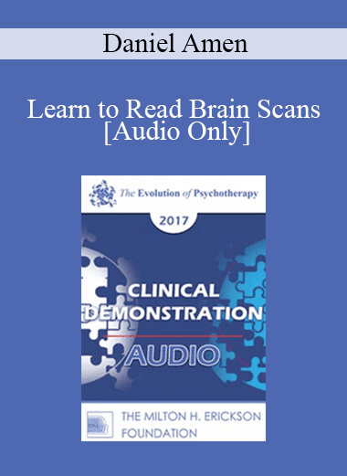 [Audio Download] EP17 Clinical Demonstration 10 - Learn to Read Brain Scans: 50 cases in 60 Minutes - Daniel Amen